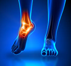 Ankle and Foot pain